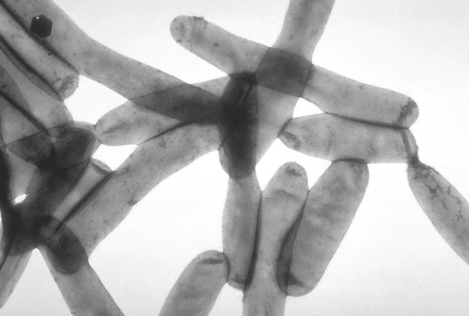 Bakterija legionele, ki povzroča legionarsko bolezen. Foto: Wikipedia